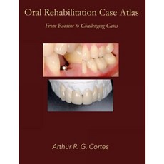 Oral Rehabilitation Case Atlas: From Routine to Challenging Cases Paperback