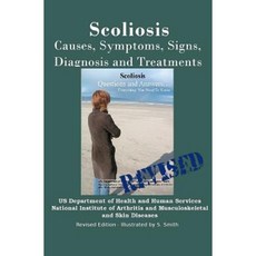 Scoliosis: Revised Edition: Causes Symptoms Signs Diagnosis and Treatments Paperback, Createspace Independent Publishing Platform