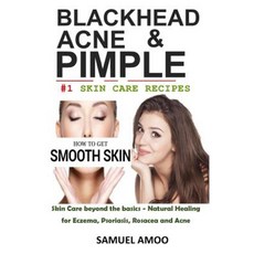 Blackheads Acne & Pimple: Blackheads Acne Pimple Home Remedies & Treatment Book Paperback, Createspace Independent Publishing Platform