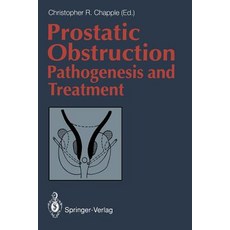 Prostatic Obstruction: Pathogenesis and Treatment Paperback, Springer