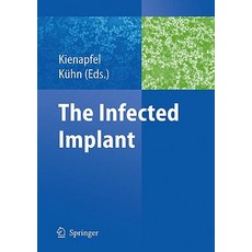 The Infected Implant Paperback, Springer