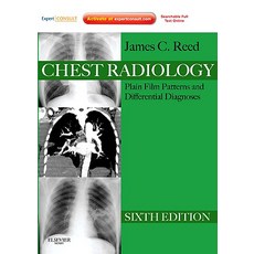 Chest Radiology: Plain Film Patterns and Differential Diagnoses [With Access Code] Hardcover, Mosby