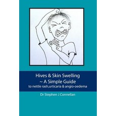 Hives & Skin Swelling a Simple Guide: To Nettle Rash Urticaria & Angio-Oedema Paperback, Createspace Independent Publishing Platform