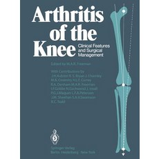 Arthritis of the Knee: Clinical Features and Surgical Management Paperback, Springer