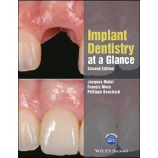 Implant Dentistry at a Glance Paperback, Wiley-Blackwell