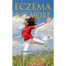 Eczema No More: The Complete Guide to Natural Cures for Eczema and a Holistic System to End Eczema & C..., Createspace Independent Publishing Platform