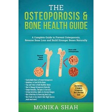 Osteoporosis: The Osteoporosis & Bone Health Guide: A Complete Guide to Prevent Osteoporosis Reverse ..., Createspace Independent Publishing Platform