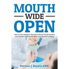 Mouth Wide Open: How to Ask Intelligent Questions about Dental Implants and Actually Understand What Y..., Steven J Brazis, Dds