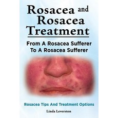 Rosacea and Rosacea Treatment. from a Rosacea Sufferer to a Rosacea Sufferer. Rosacea Tips and Treatme..., Imb Publishing Rosacea Rosacea Treatment