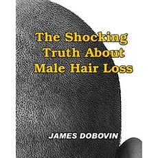 The Shocking Truth about Male Hair Loss: Secrets You Need to Know about Losing Hair So You Can Stop fr..., Createspace Independent Publishing Platform