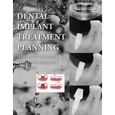 Dental Implant Treatment Planning for New Dentists Starting Implant Therapy Paperback, Authorhouse