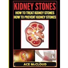Kidney Stones: How to Treat Kidney Stones: How to Prevent Kidney Stones Hardcover, Pro Mastery Publishing