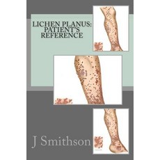 Lichen Planus: Patient's Reference Paperback, Createspace Independent Publishing Platform