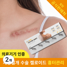 의료기기 힐텀 시카 겔 시트 흉터 관리 실리콘 겔 밴드, 2개, 1개입
