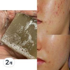 네이처레시피 딥클렌징 모낭충 비누 모냥염 비누 청소년 지루성 피부 수제비누, 100g, 2개입