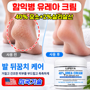 유리아 크림 유레아 크림 100% 함익병 유리아 크림 피부 연화제 합익병 유레아 크림 뒷꿈치 보습크림 발각질 제거 우레아 풋크림 YONICE보장증정