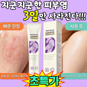 [피부염 집중 케어] 피부 진정 케어 크림 스킨 수당 크림 건조 보습 LUPEIYA, 1개, 20g