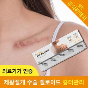 의료기기 힐텀 시카 겔 시트 흉터 관리 실리콘 겔 밴드