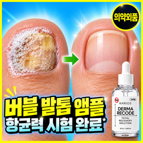 [버블 타입] 발톱 곰팡이1위 발톱 앰플 곰팡이 한번에 끝내는 문제성 발톱1위 네일 케어 무조무 발톱무조무발톱