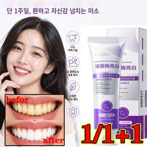 1/1+1 [누런 이 노란기 싹 잡는 미백 치약] 스타 다이아 나노 미백 치약