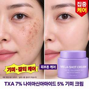 트라넥삼산 100% 정품 멜라논 크림 기미 잡티 제거 크림1위 나이아신아마이드 기미잡티크림 트라넥삼산 기미크림1위 누룩밤 수면팩 얼굴 미백크림1위