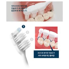 덴클 올인원 이중미세모 칫솔 12개입 1세트