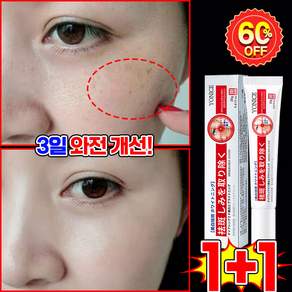 [100% 개선] 기미크림 기미 잡티 검버섯 흑자 제거크림 멜라닌 색소침착 크림 멜라논 착색크림 미백 피부 진정 케어 LUPEIYA