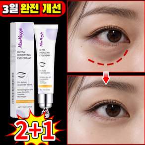 [당일출고 | 미국기술] 리프팅 900샷 아이크림 눈 밑 지방 제거 크림 주름개선 아이크림1위 아이백 크림 다크서클 눈밑꺼짐 제거 PDPN 포장증정