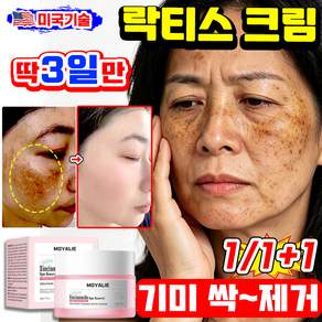 [피부과 추천] 락티스 크림 미백크림 젖소크림 기미 잡티 제거 크림1위 기미원 크림 주근깨 케어 나이아신아마이드 미백 화이트닝 색소침착 착색크림 들깨기미크림 YONICE 포장증정