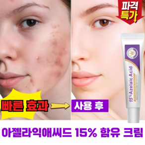 Gurene 아젤라익애씨드 15% 함유 크림 트러블로 생긴 잡티 & 모공 관리
