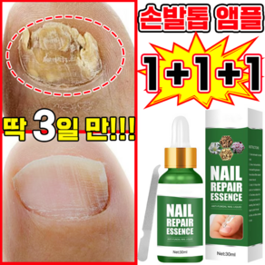 [국내배송] 발톱 앰플 문제성 발톱 곰팡이 한번에끝내는 손발톱 영양제 MOYALIE 보장증정