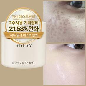 아들레이 화이트닝 색소침착 기미 주근깨 잡티 착색 미백크림
