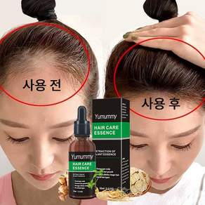 Hair Hair Grower 영 양 두 피 케 어 세 럼