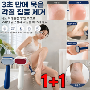 1+1나노글라스 양면 풋케어 리무버 양면 홈케어 발 각질 제거기 발바닥 굳은살 제거 발각질 제거 도구