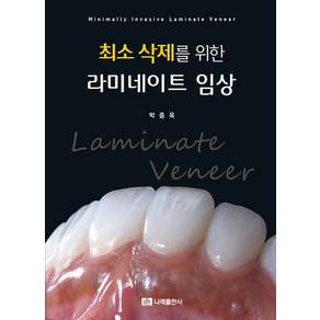 최소 삭제를 위한 라미네이트 임상