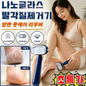 나노글라스 발각질제거기 양면 풋케어 리무버 나노글라스 양면 풋케어 리무버 양면 홈케어 발 각질 제거기 발바닥 각질제거기 굳은살 제거기 사은품 랜덤 증정