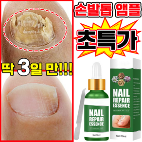 [국내배송] 발톱 앰플 문제성 발톱 곰팡이 한번에끝내는 손발톱 영양제 MOYALIE 보장증정