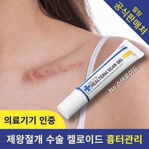 [의료기기] 힐텀스카겔 흉터 관리 케어 15g