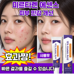 [피부과 전문의 추천]함익병 멜라논 크림 동아&제약 함익병 기미 잡티 제거 멜라논 크림 착색크림 함익병