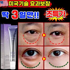 [당일발송]1/1+1/2+2 주름개선 아이크림1위 리프팅 900샷 아이크림 눈밑지방 제거 아이백 크림 다크서클 눈밑꺼짐 제거 아이케어 MOYALIE