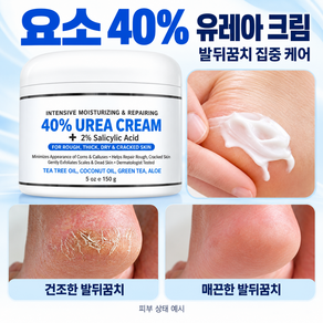 [새로운 업그레이드][당일배송] 함익병 유레아 크림 100% 함익병 유리아 크림 뒷꿈치 우레아 풋크림 발뒤꿈치 각질제거 보습크림