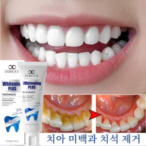 미백 치약 Whitening Toothpaste 프로바이오틱스 치약 치태 치약 치태 제거 프로바이오틱스 미백 치약 프로바이오틱스 치태 치약 구취 제거