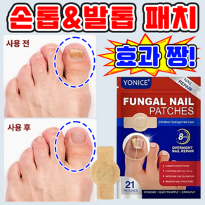 손발톱 강화 풋케어 패치 발톱 곰팡이 패치 기본형 발톱 패치 케어 밴드 MOYALIE보장증정