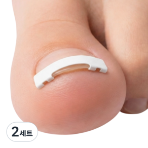 라이언문 니티놀 내성발톱 교정 의료기기
