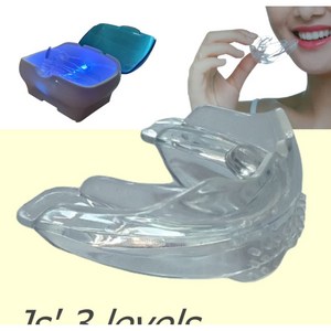이갈이 방지 셀프 마우스피스 치료 치아 교정 앞니 부분 교정기, 1개, 레벨2