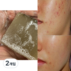 네이처레시피 딥클렌징 모낭충 비누 모냥염 비누 청소년 지루성 피부 수제비누, 100g, 2개입