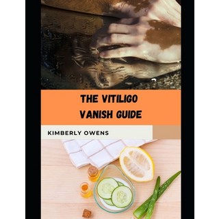 (英文圖書) The Vitiligo Vanish Guide: Alternative and Homeopathic Paths to Treating Vitiligo 平裝版, Independently Published, 英文