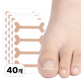 로멀리 내성발톱 테이프 보호 밴드, 40개