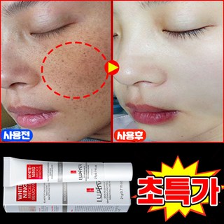 [100% 효과있음] 멜라논 크림 기미크림 기미 잡티 주근깨 검버섯 제거 크림 착색 미백 크림 들깨기미크림 색소침착 화이트닝 LUPEIYA 포장증정, 1개, 21g