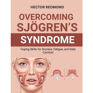 (英文圖書)Overcoming Sjögren's Syndrome： Coping Skills for Dryness Fatigue and Daily Com... 平裝版, Independently Published, English